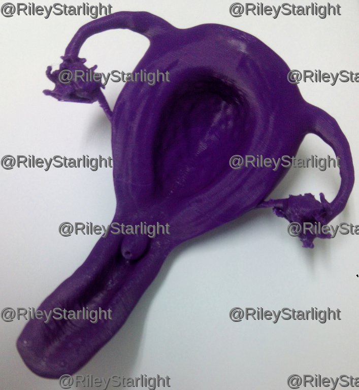 Impresión 3D de un modelo de útero. Modelo «Anatomical Uterus, Vagina, and Internal Sex Organs» realizado por Amy Stenzel (CC BY).